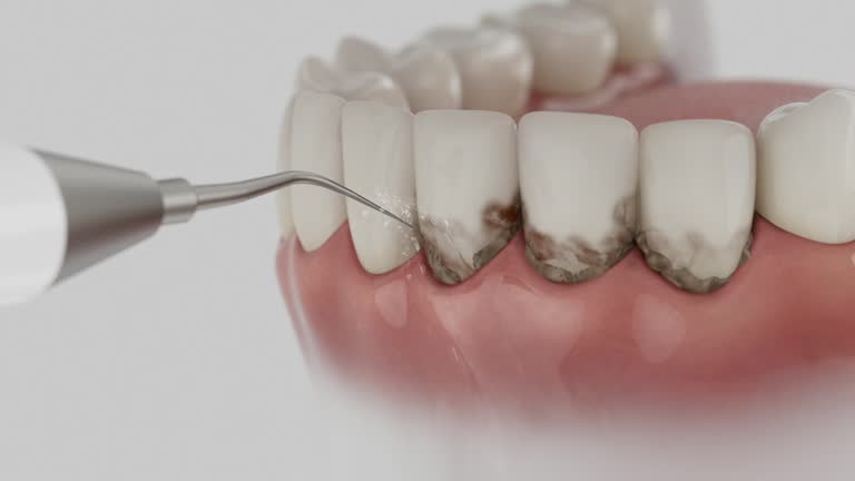 Reliable Wisdom Tooth Removal contractor in Osceola County County, MI by Dentist Open Now